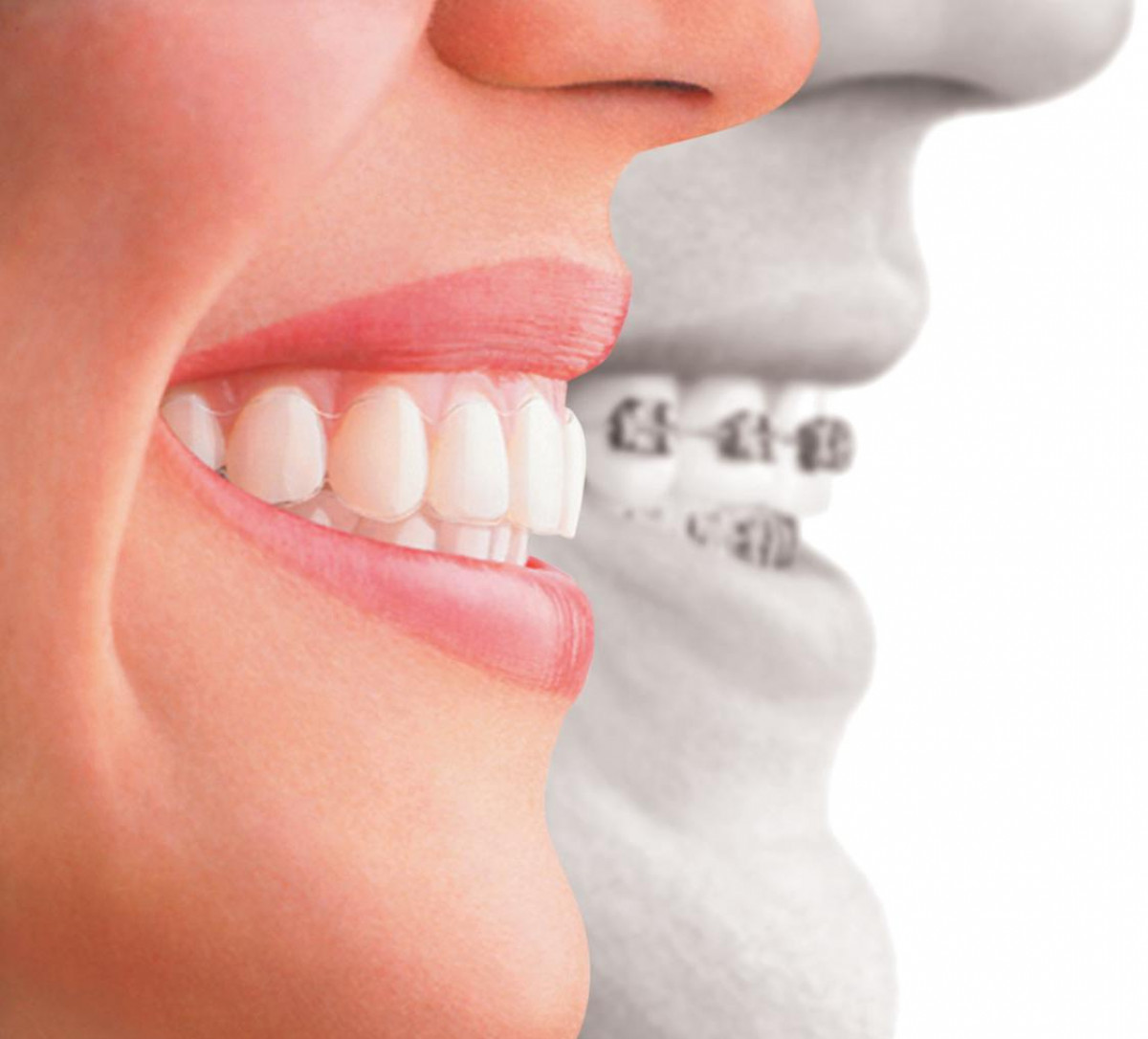 imagen Clínico Integral de Ortodoncia | Nivel: Superior