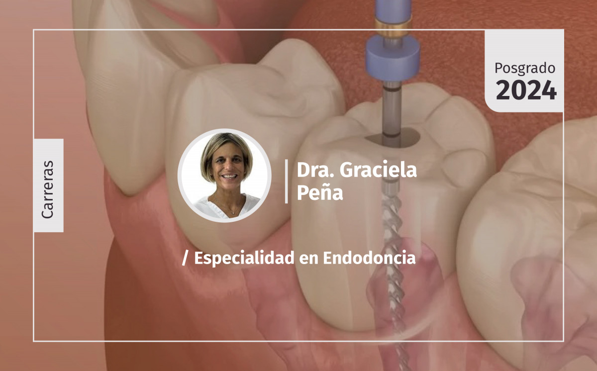 imagen Endodoncia