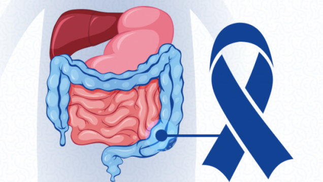 imagen "Si te controlás, lo prevenís": la UNCUYO concientiza sobre el cáncer de colon