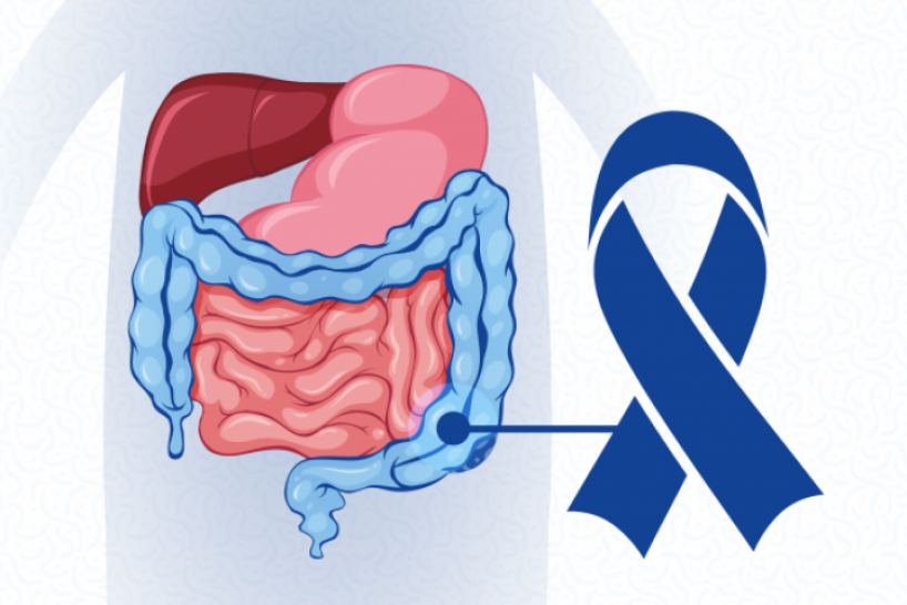 imagen "Si te controlás, lo prevenís": la UNCUYO concientiza sobre el cáncer de colon