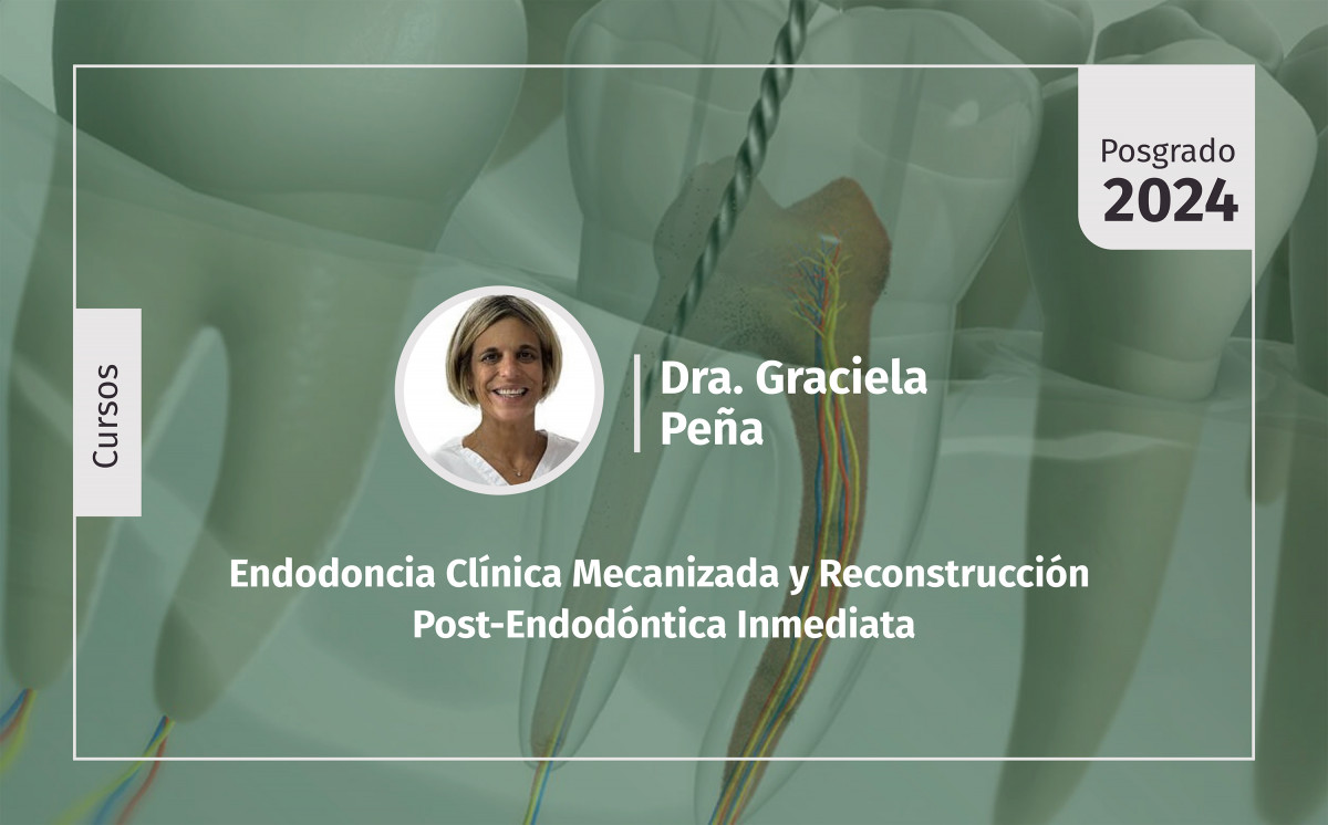 imagen Endodoncia Clínica Mecanizada y Reconstrucción Post-Endodóntica Inmediata