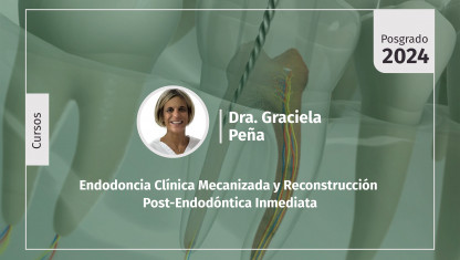 imagen Endodoncia Clínica Mecanizada y Reconstrucción Post-Endodóntica Inmediata