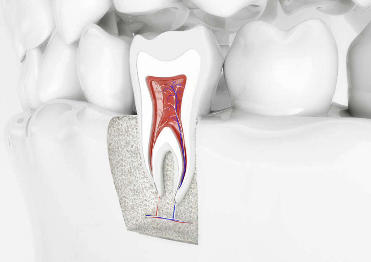 imagen Los problemas generan oportunidades: Desde las endodoncias simples, seguras y eficientes a la restauración estética adhesiva
