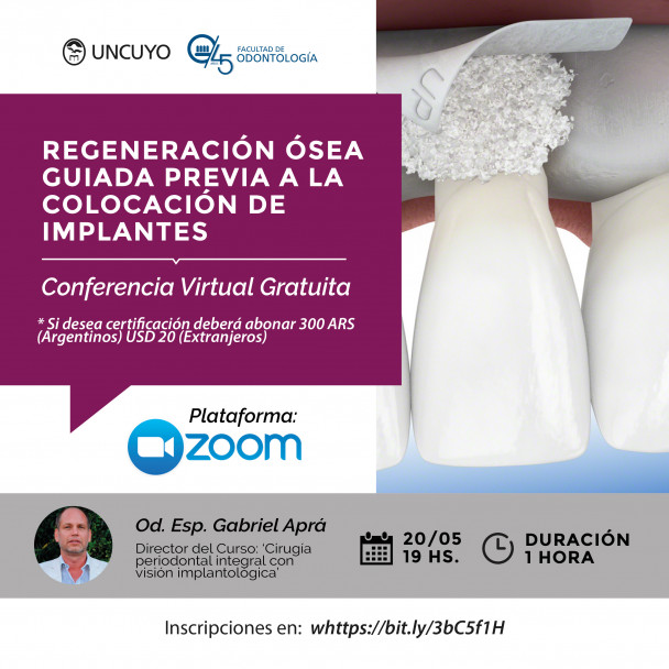 imagen Se acerca una Conferencia Virtual Gratuita sobre "Regeneración Ósea"