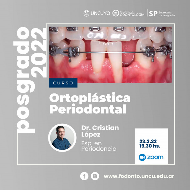 imagen Se dictará un curso de Posgrado sobre "Ortoplástica Periodontal"