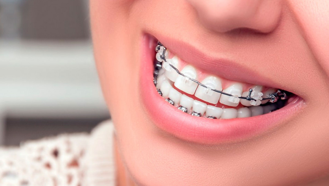 imagen Servicio de Ortodoncia y Ortopedia Dentofacial