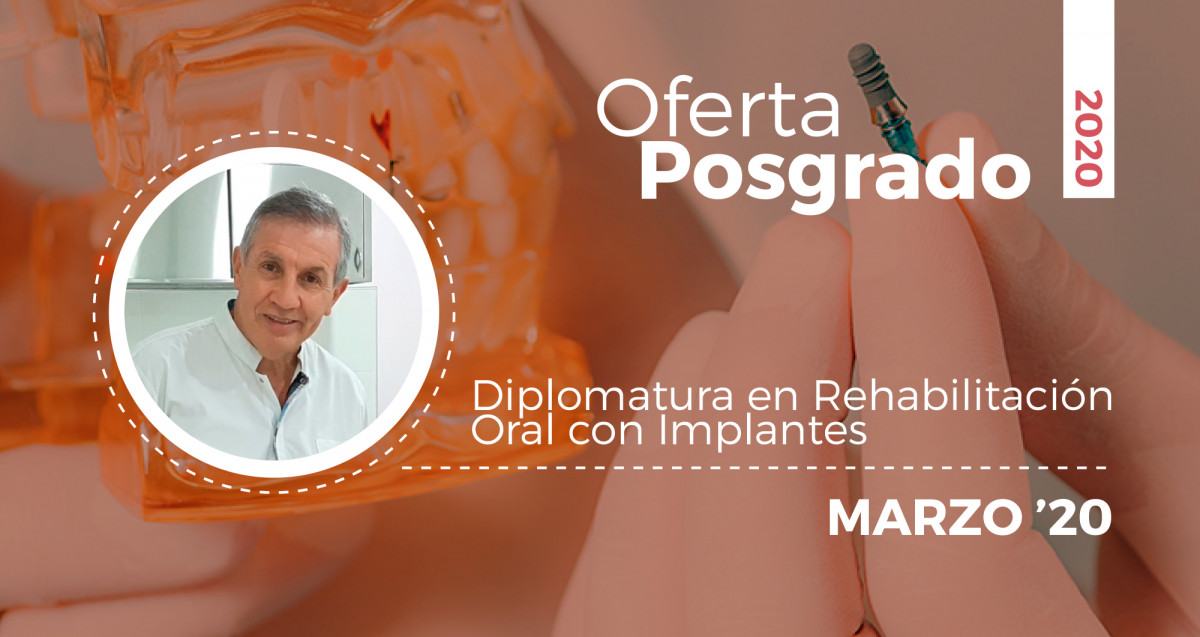 imagen Rehabilitación Oral con Implantes