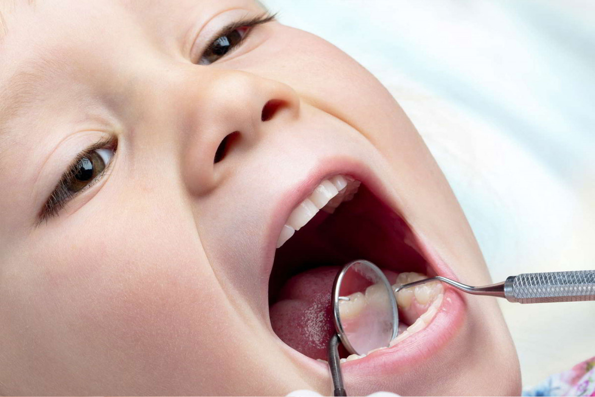 imagen Hábitos Orales en Odontopediatría