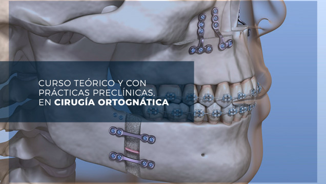 imagen Especialistas dictarán un curso intensivo sobre Cirugía Ortognática