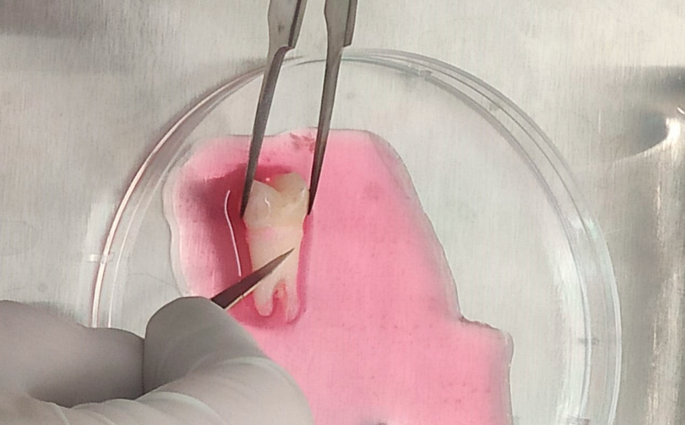 imagen Investigadores de la FO logran aislar, crecer y congelar Células Madre de ligamento periodontal