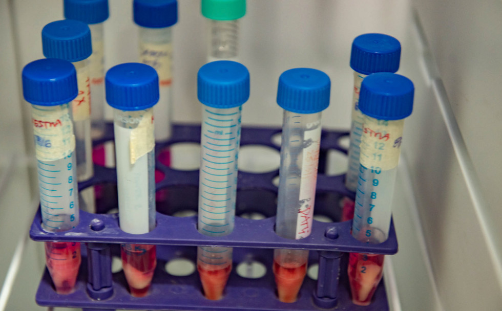 imagen Investigadores de la FO logran aislar, crecer y congelar Células Madre de ligamento periodontal