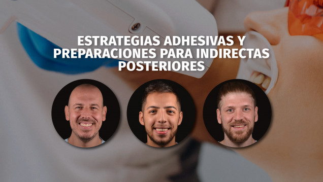 imagen Grupo Cúspide presenta el curso intensivo: Estrategias adhesivas y preparaciones para indirectas posteriores 