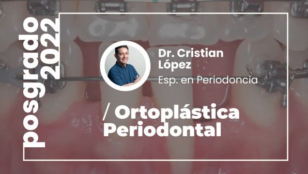 imagen Se dictará un curso de Posgrado sobre "Ortoplástica Periodontal"