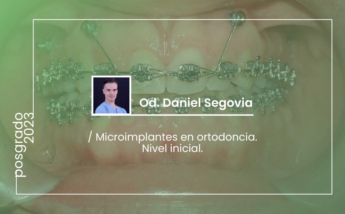 imagen Microimplantes en ortodoncia. Nivel inicial