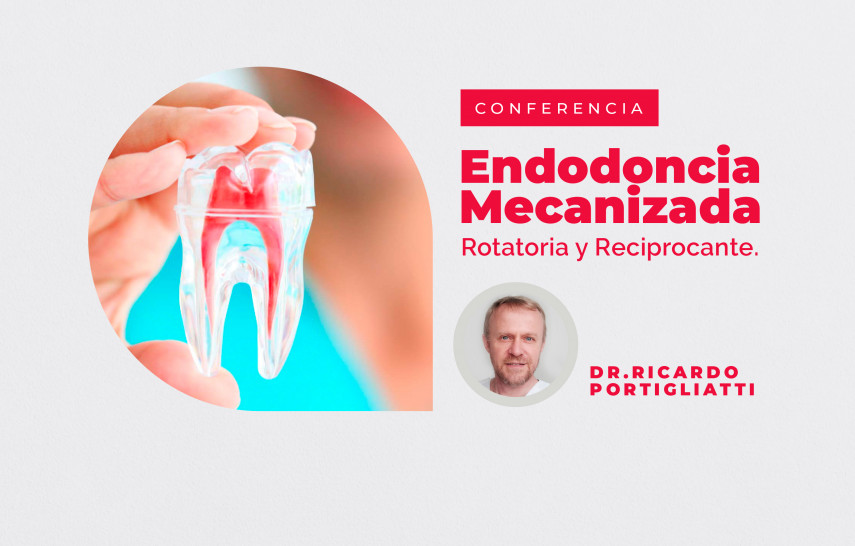 imagen Se acerca una conferencia sobre Endodoncia Mecanizada