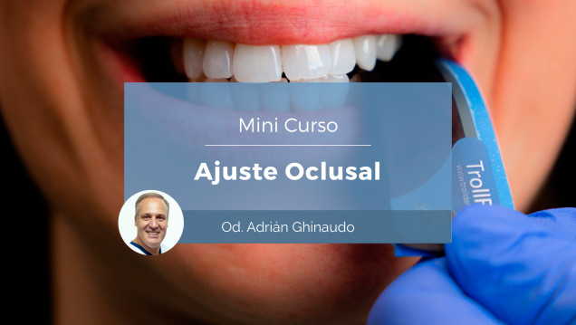 imagen Se dictará el mini curso: Ajuste Oclusal