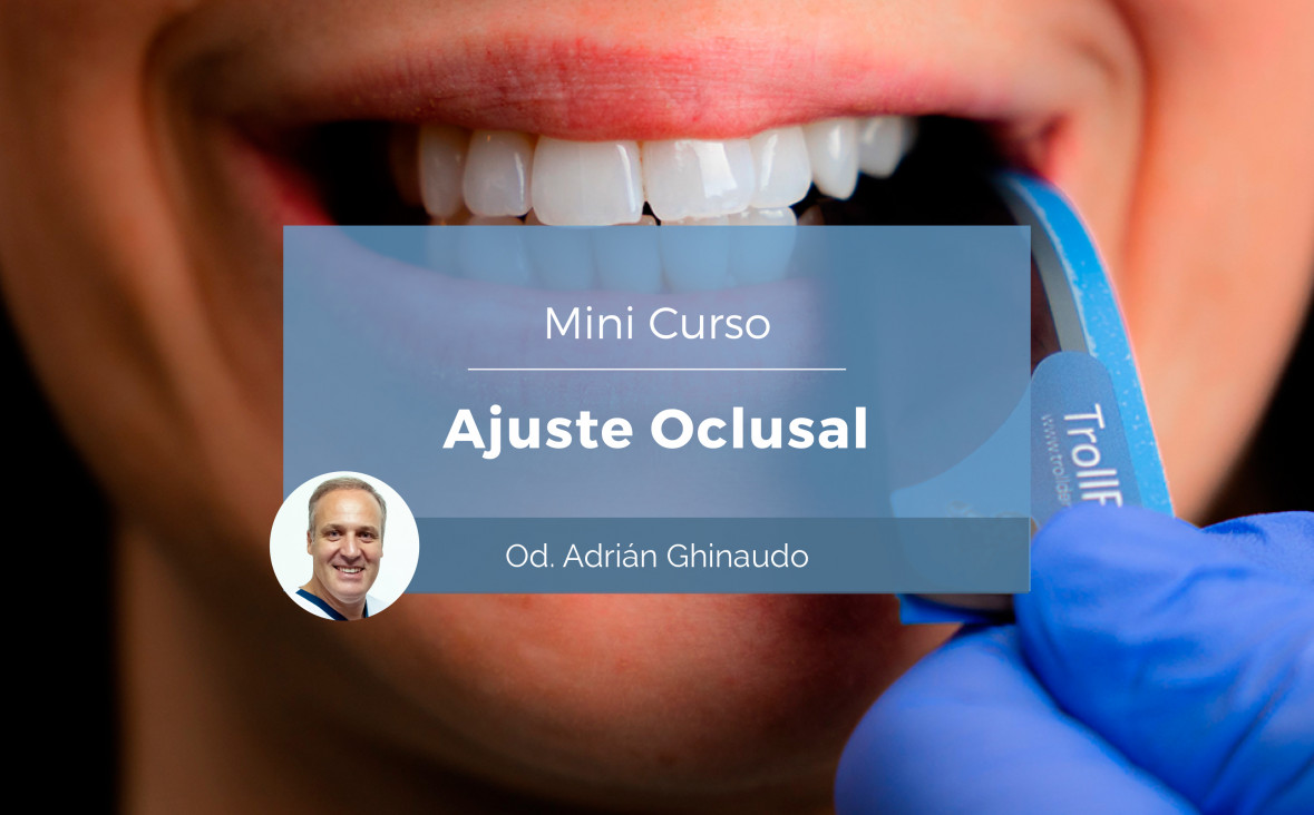 imagen Se dictará el mini curso: Ajuste Oclusal