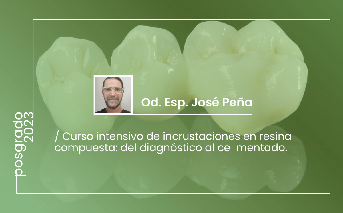 imagen Curso intensivo de Incrustaciones en Resina Compuesta: del diagnóstico al Cementado.