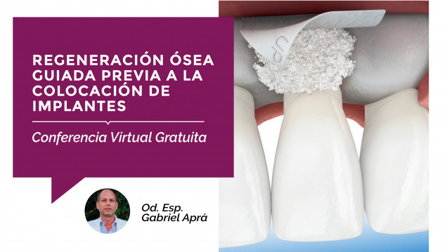 imagen Se acerca una Conferencia Virtual Gratuita sobre "Regeneración Ósea"