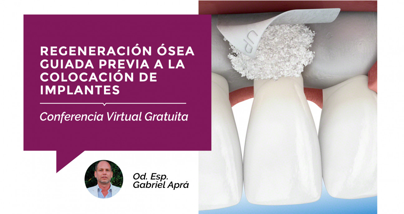 imagen Se acerca una Conferencia Virtual Gratuita sobre "Regeneración Ósea"