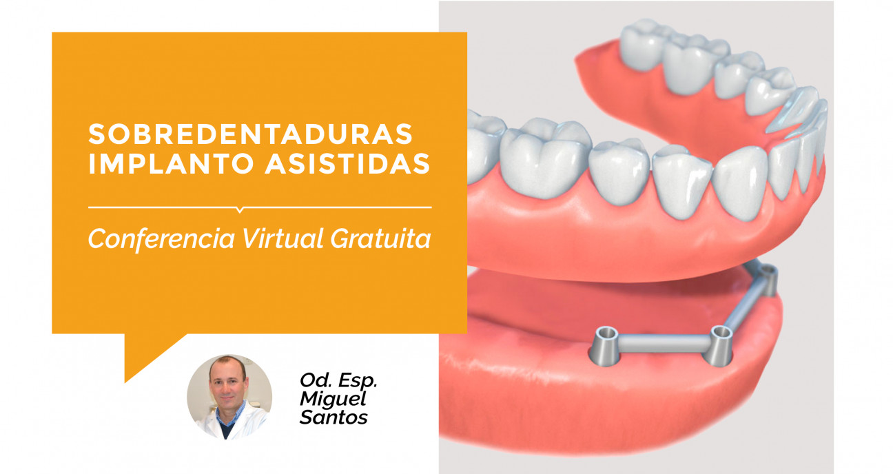 imagen Se brindará la Conferencia Virtual Gratuita: "Sobredentaduras Implanto-Asistidas"