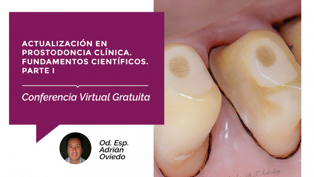 imagen Se acerca una nueva conferencia virtual gratuita, sobre Prostodoncia Clínica