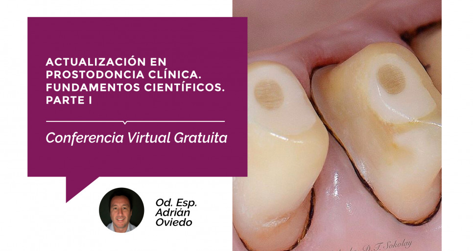 imagen Se acerca una nueva conferencia virtual gratuita, sobre Prostodoncia Clínica